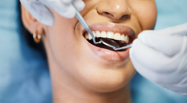 Best Emergency Tooth Extraction in Robstown, TX
